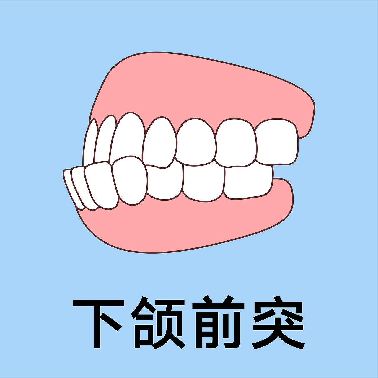 口腔 医美 牙齿类型 矫正 种植 牙齿轮廓（蓝色背景）（图ZMzgxMjM0Njg0） - 艺术插画 - 站酷设计师想想都开心原创素材 - 站酷ZCOOL