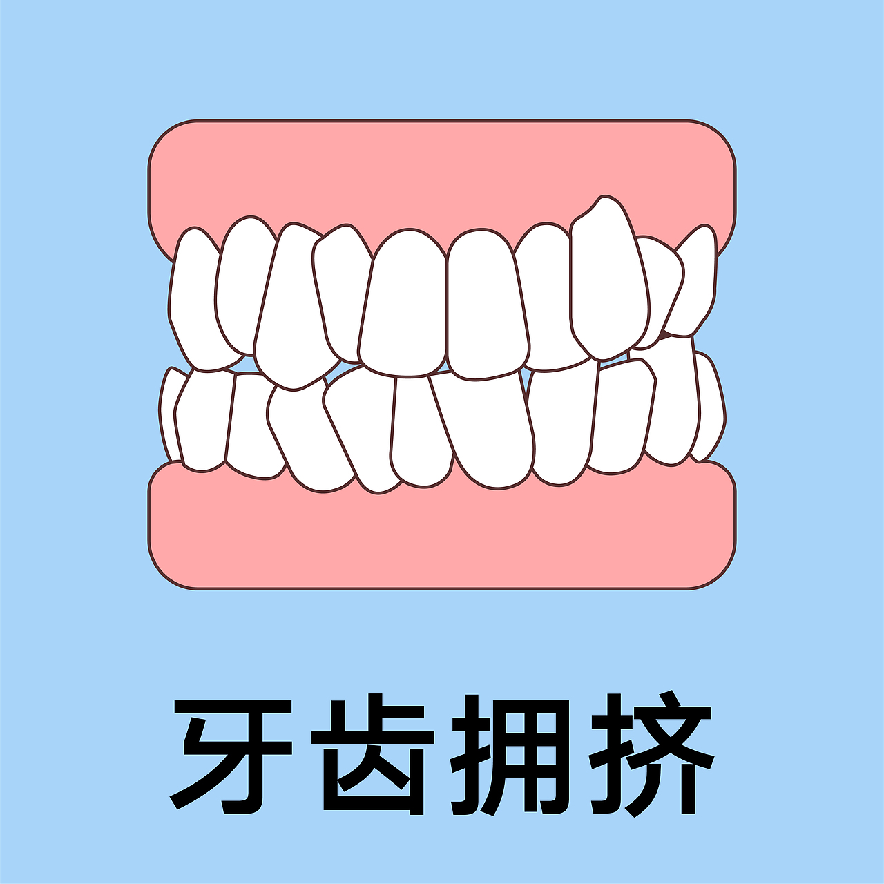 口腔 医美 牙齿类型 矫正 种植 牙齿轮廓（蓝色背景）（图ZMzgxMjM0Nzk2） - 艺术插画 - 站酷设计师想想都开心原创素材 - 站酷ZCOOL