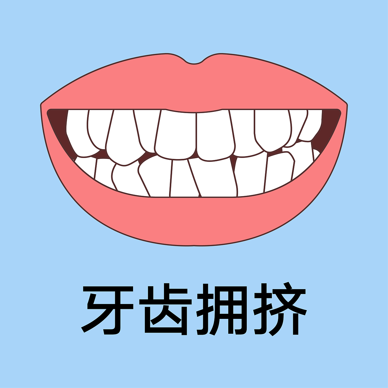 口腔 医美 牙齿类型 矫正 种植 嘴唇轮廓(蓝色背景)
