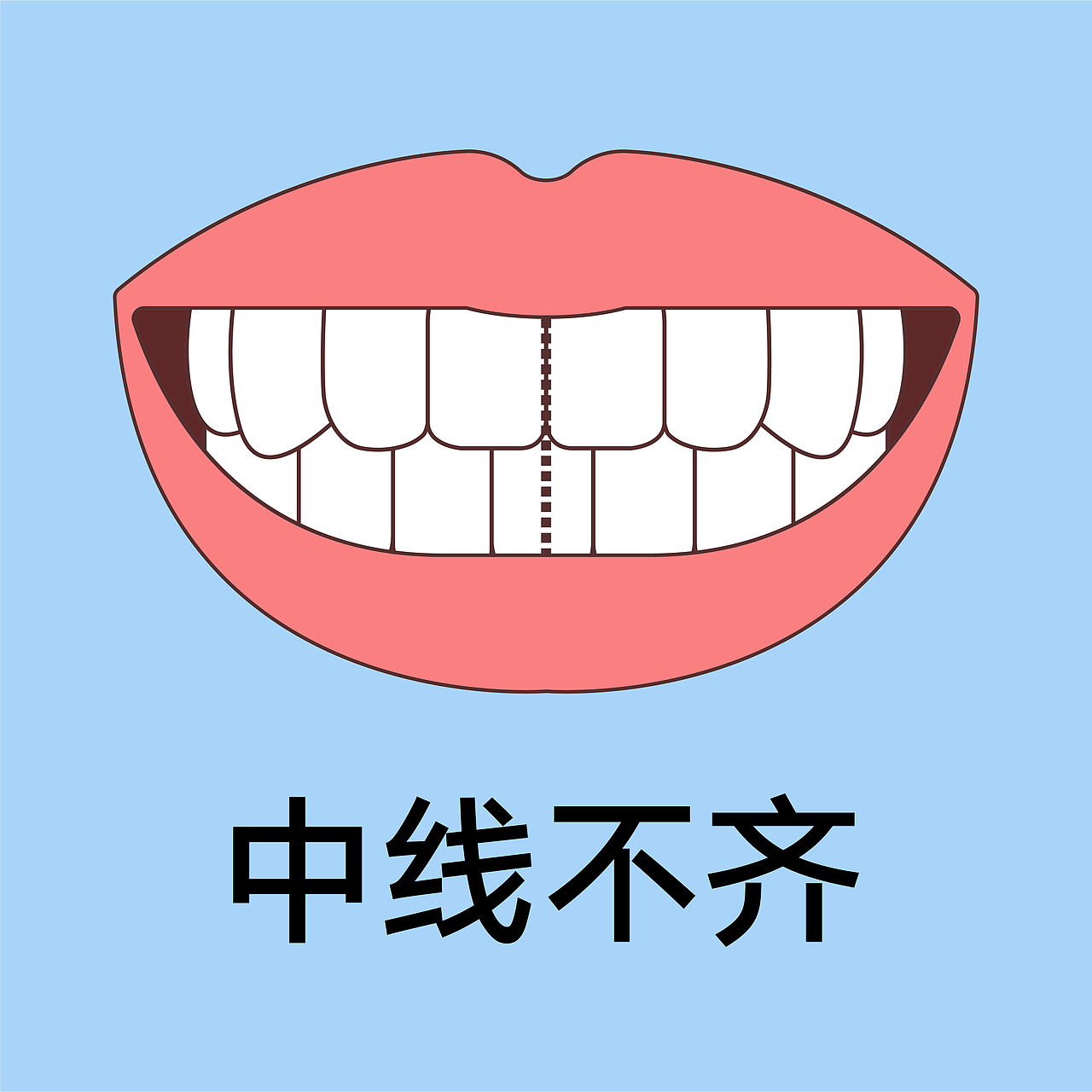 口腔 医美 牙齿类型 矫正 种植 嘴唇轮廓(蓝色背景)