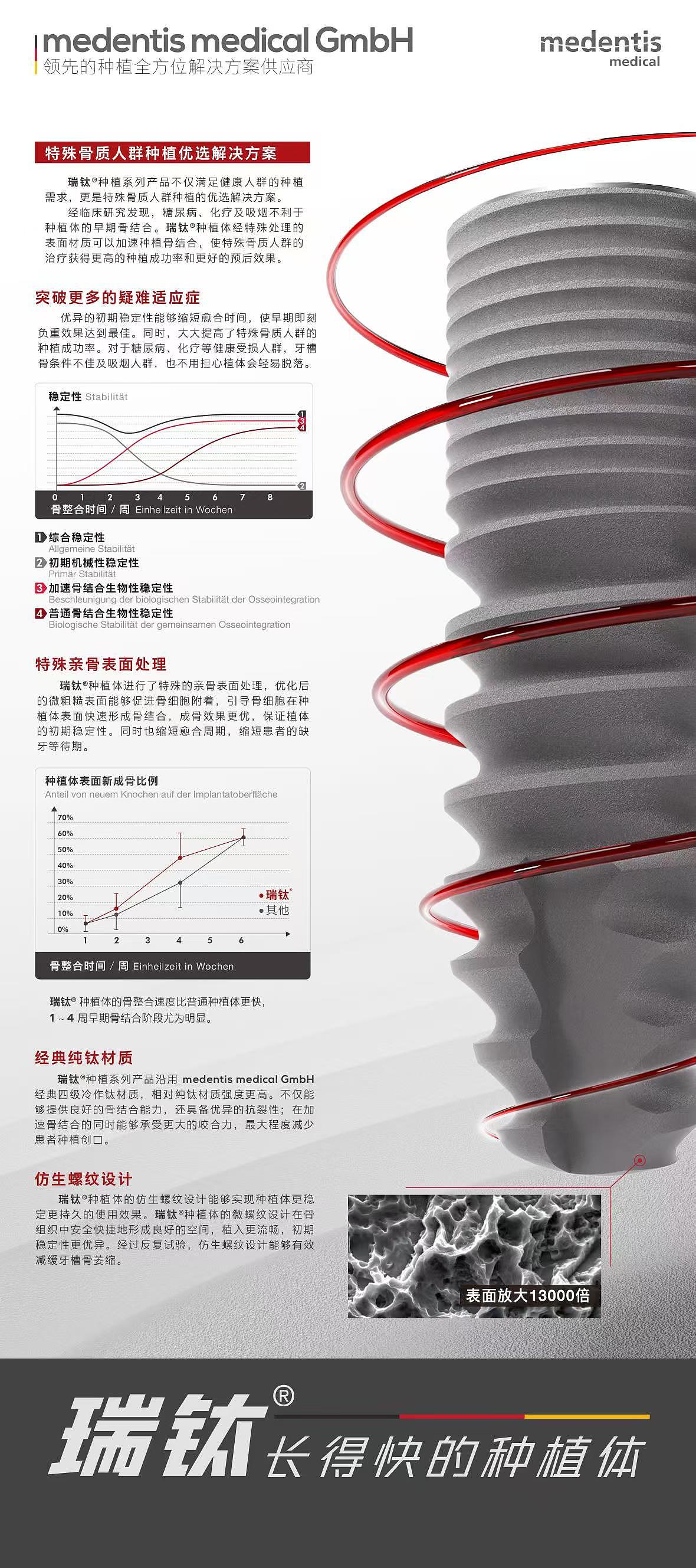 【产品动画】种植体宣传视频（未配音版）（图ZMzgxODA5NDQw） - 动画/影视 - 站酷设计师Jazz_张嘉杰原创素材 - 站酷ZCOOL