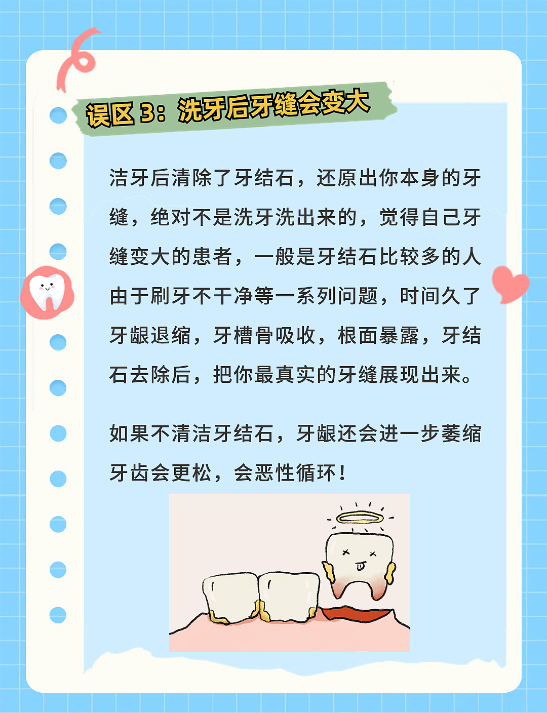 这些洗牙谣言,你信了几个