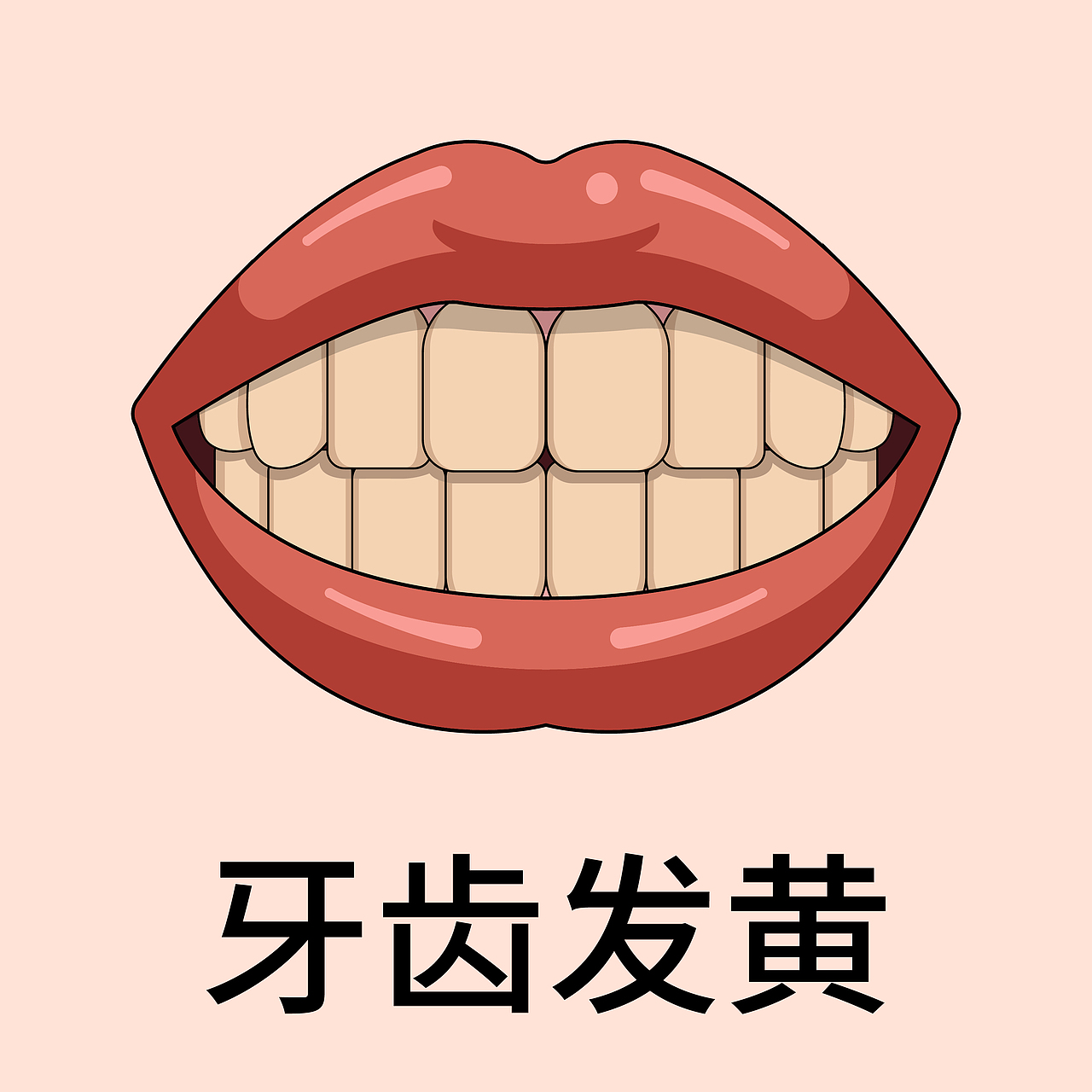 口腔 医美 牙齿类型 牙齿贴面（注释）