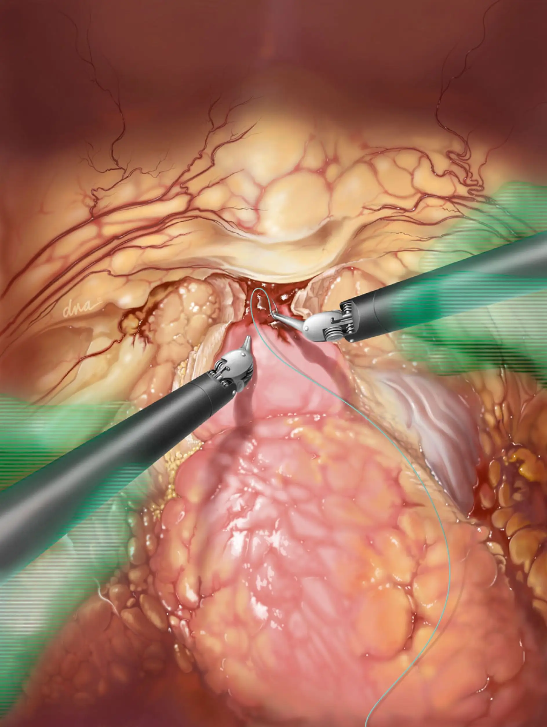 2025日本文具大赏出炉/IllustrationX预测2025插画趋势/OLIVE YOUNG 更新 LOGO