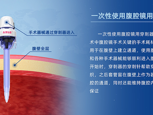 腹壁穿刺器