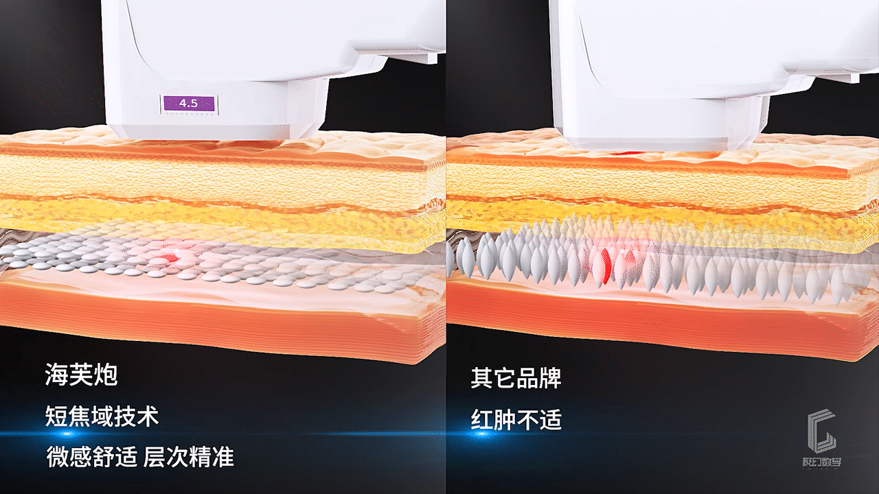 美容仪器超声炮三维产品宣传视频