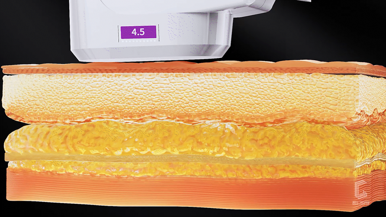 美容仪器超声炮三维产品宣传视频