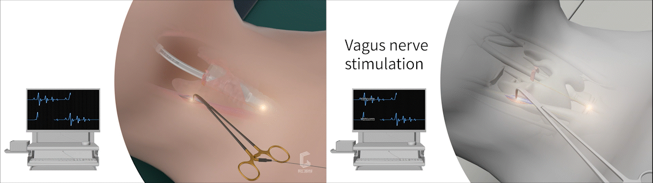 手术器具手术钳产品动画视频演绎#医学动画#医疗动画