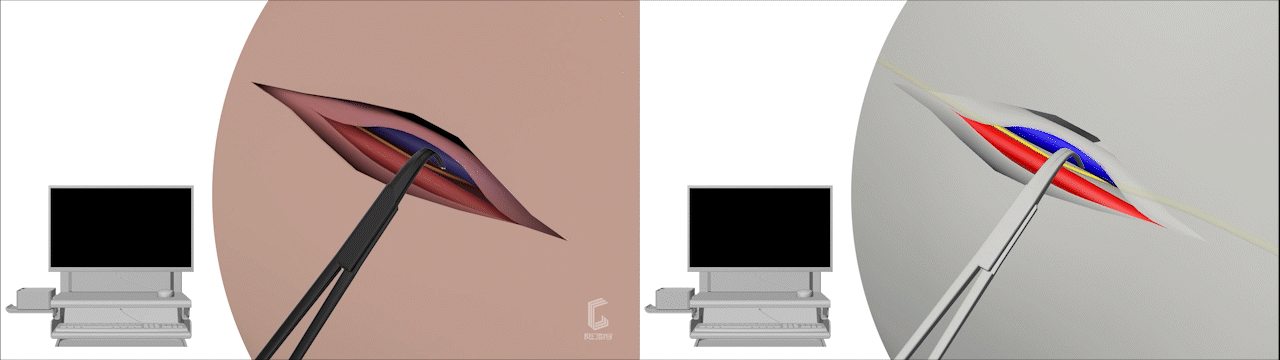 手术器具手术钳产品动画视频演绎#医学动画#医疗动画