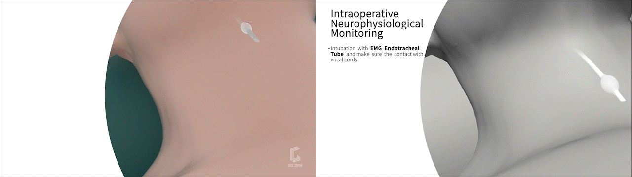 手术器具手术钳产品动画视频演绎#医学动画#医疗动画