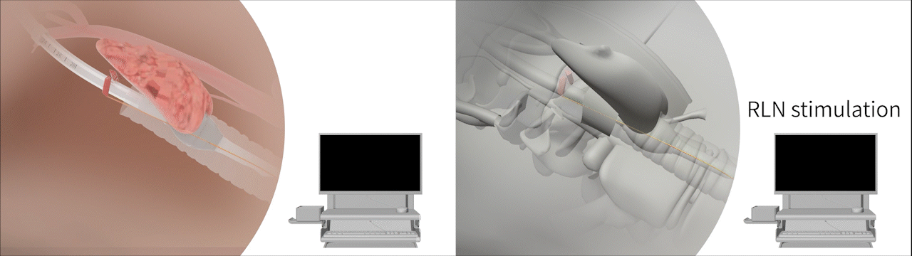 手术器具手术钳产品动画视频演绎#医学动画#医疗动画