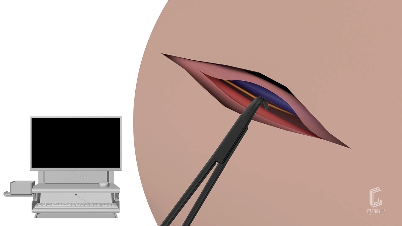 手术器具手术钳产品动画视频演绎#医学动画#医疗动画