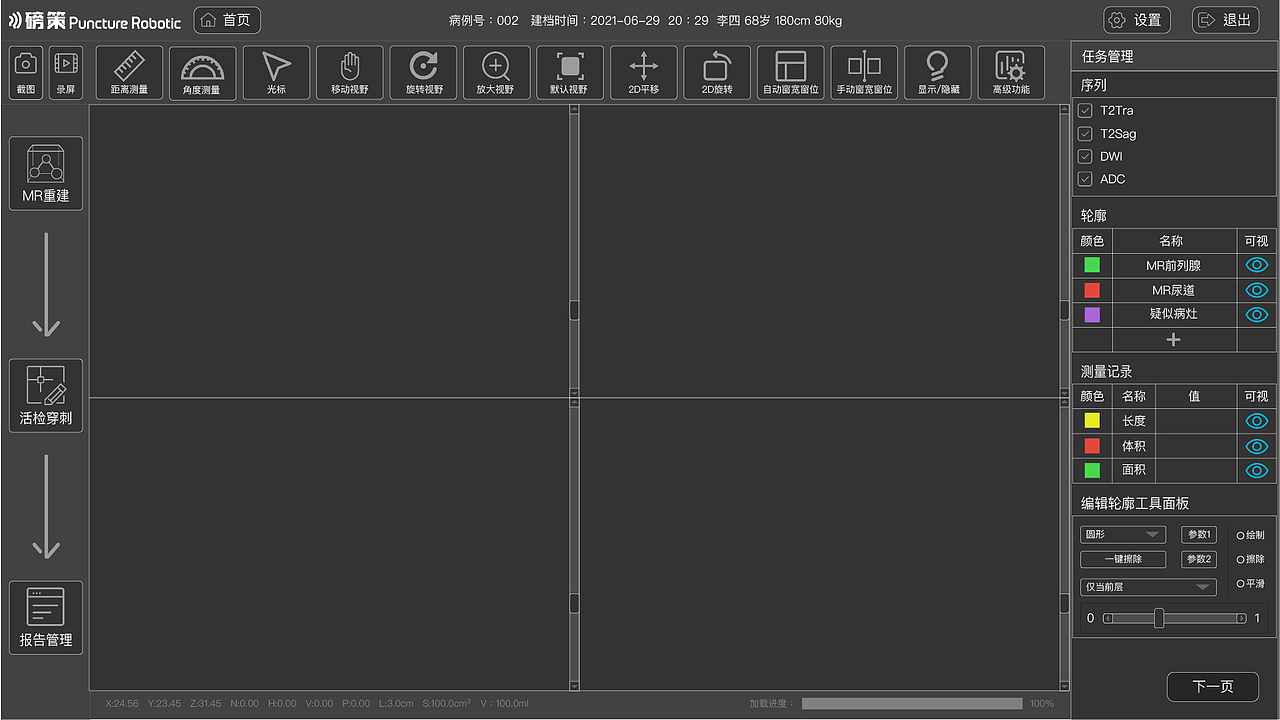 前列腺手术导航系统界面节选