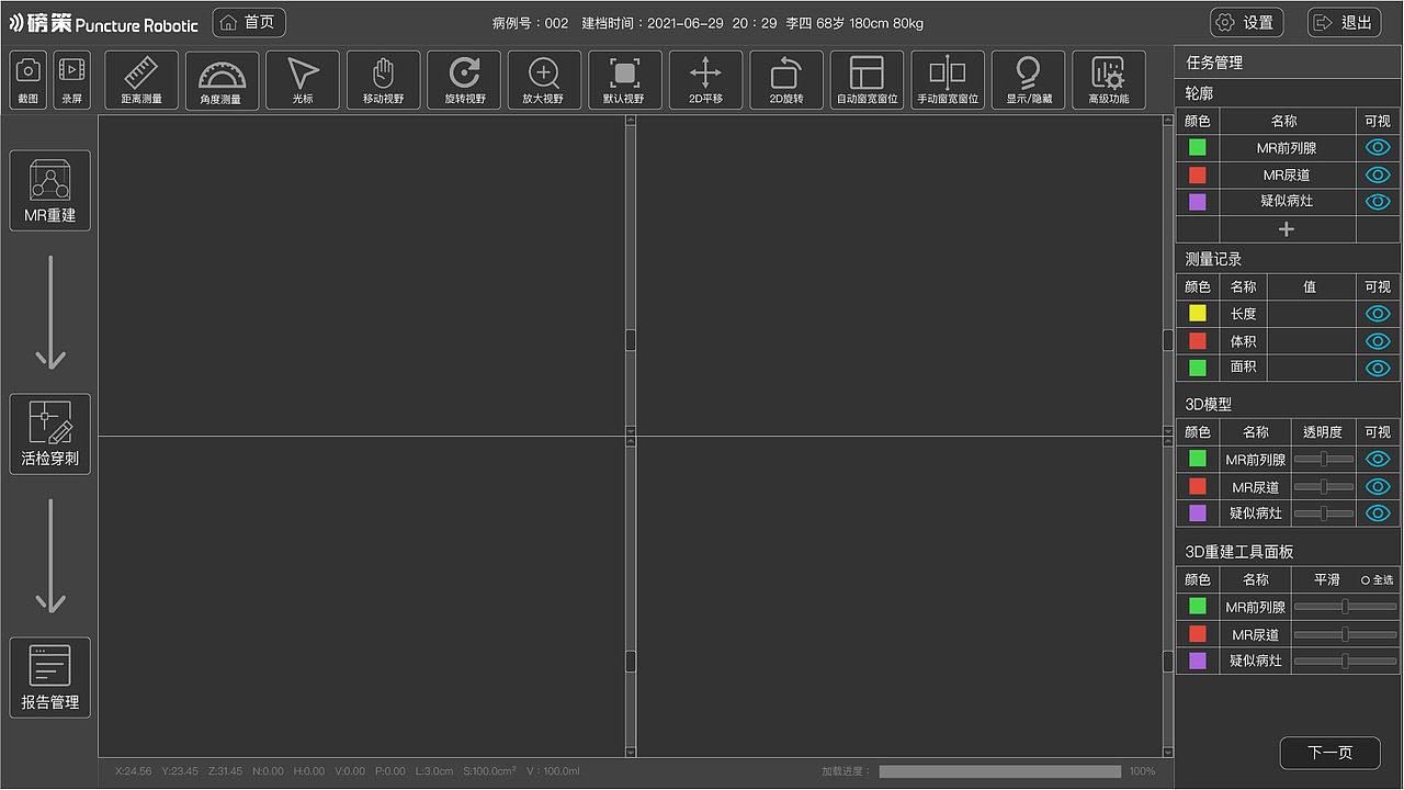 前列腺手术导航系统界面节选