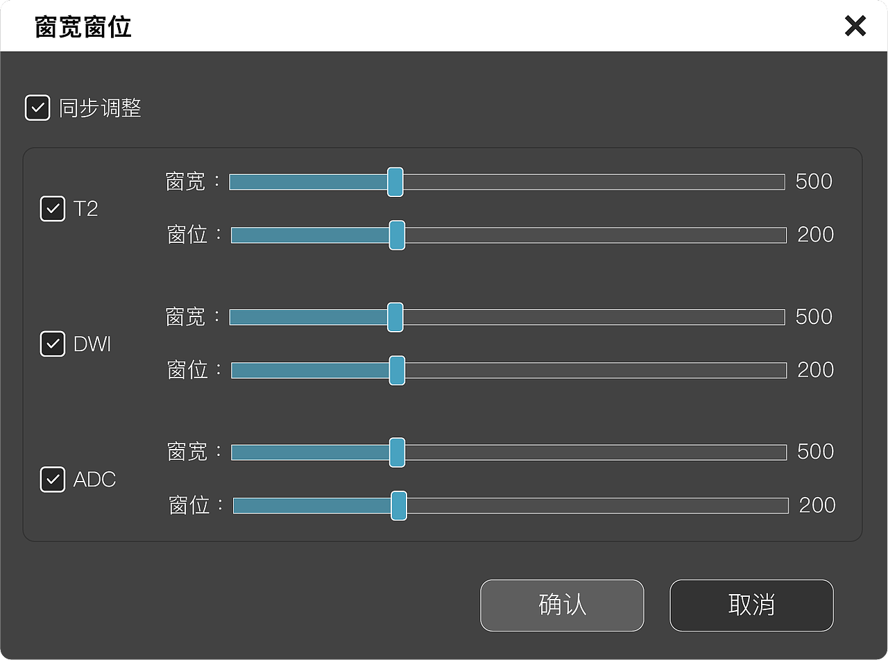 前列腺手术导航系统界面节选