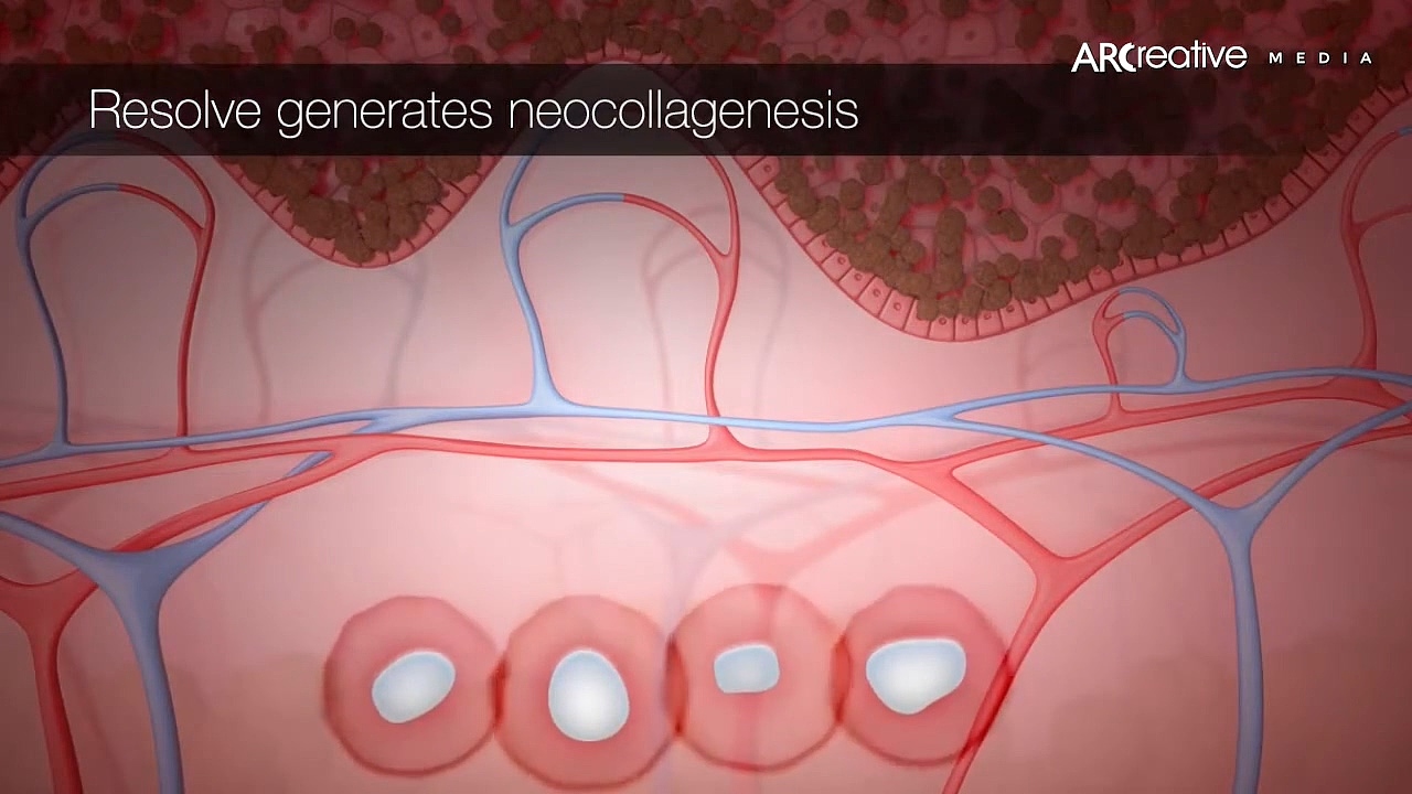 美容仪皮秒激光器三维视频演绎动画（图ZMzg5MzIzNDA0） - 工业用品/机械 - 站酷设计师极幻数字科技原创素材 - 站酷ZCOOL