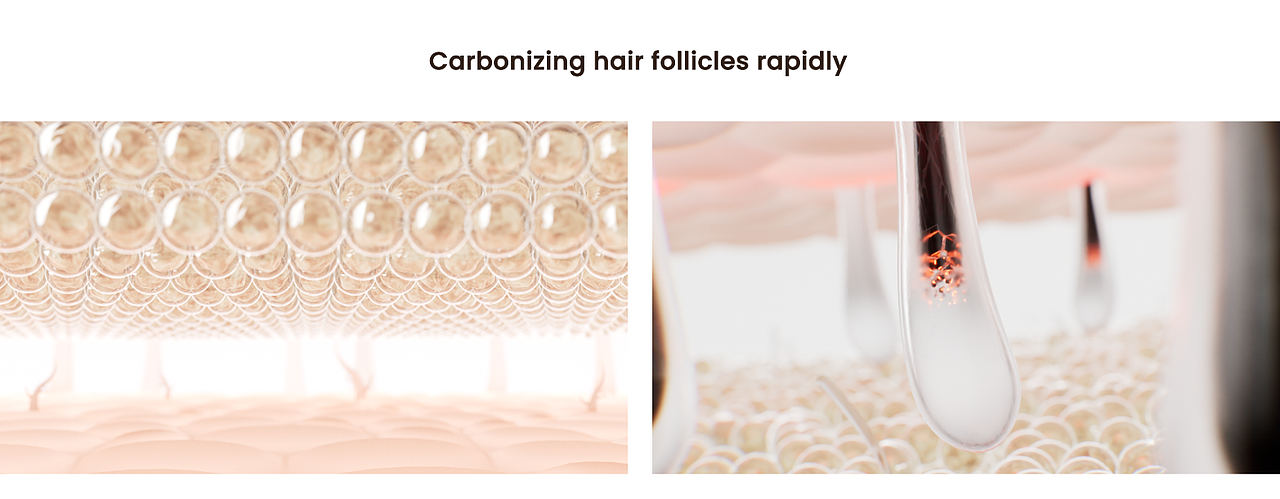 DT015pro 脱毛仪三维展示视频（图ZMzg5ODA5NDQ0） - 产品 - 站酷设计师零叁贰壹_原创素材 - 站酷ZCOOL