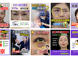不开刀去眼袋