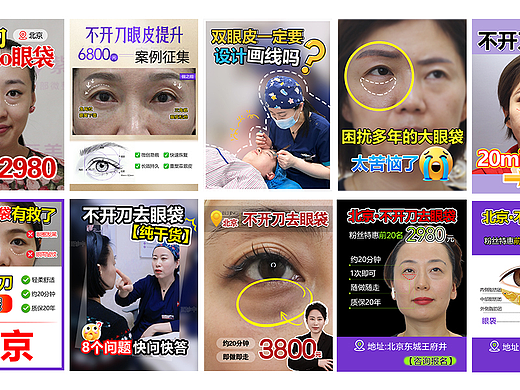 不开刀去眼袋