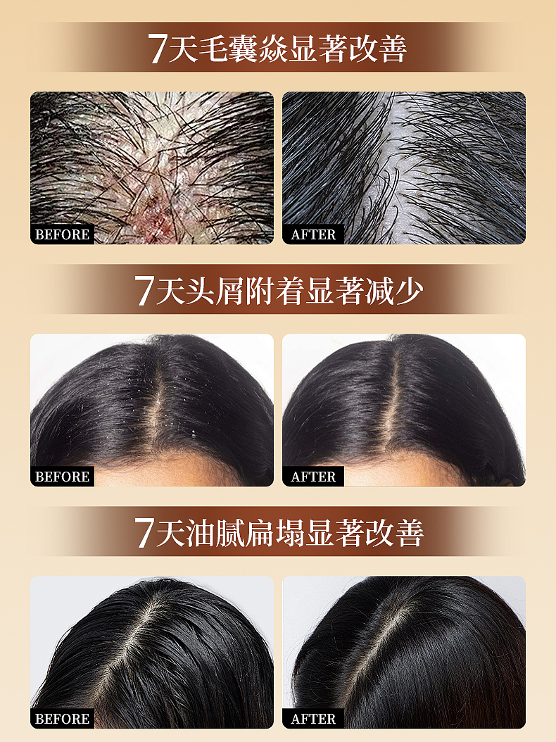 毛囊洗发水 | 详情展示（图ZMzkwODMyNDQw） - 电商 - 站酷设计师RULU512原创素材 - 站酷ZCOOL