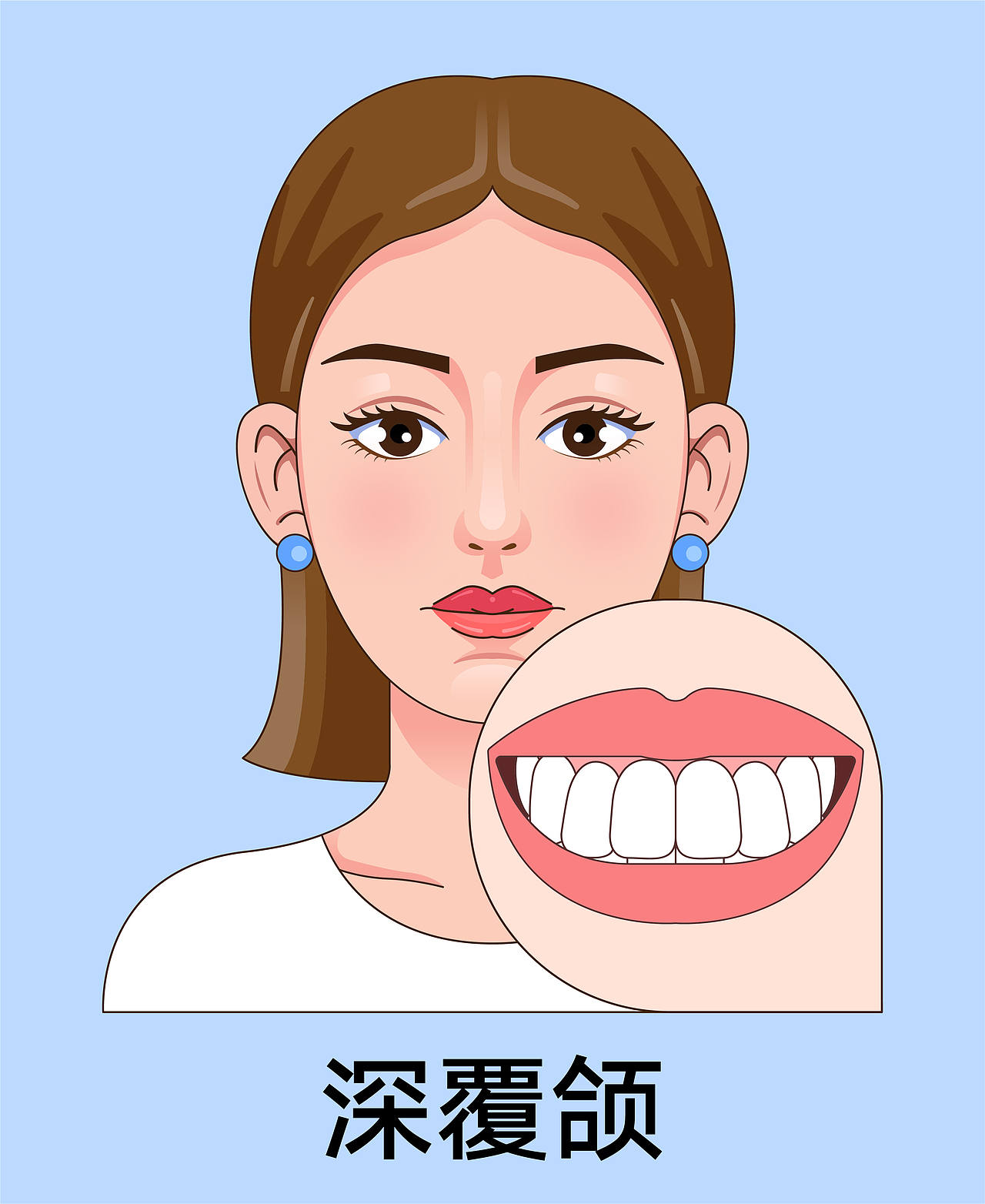 医美 口腔插画 女孩正颜 牙齿矫正类型(蓝色背景)