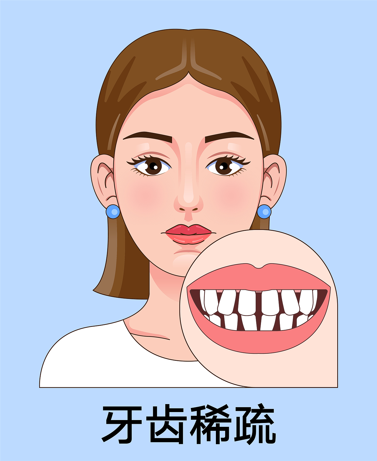 医美 口腔插画 女孩正颜 牙齿矫正类型(蓝色背景)