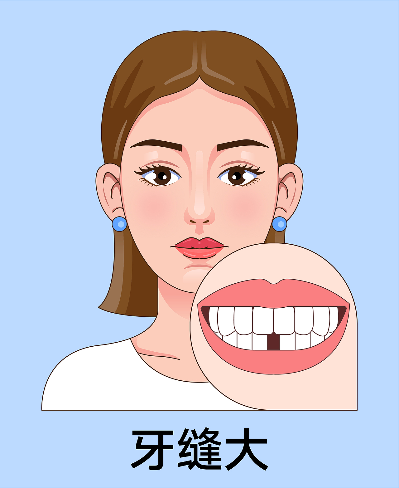 医美 口腔插画 女孩正颜 牙齿矫正类型(蓝色背景)