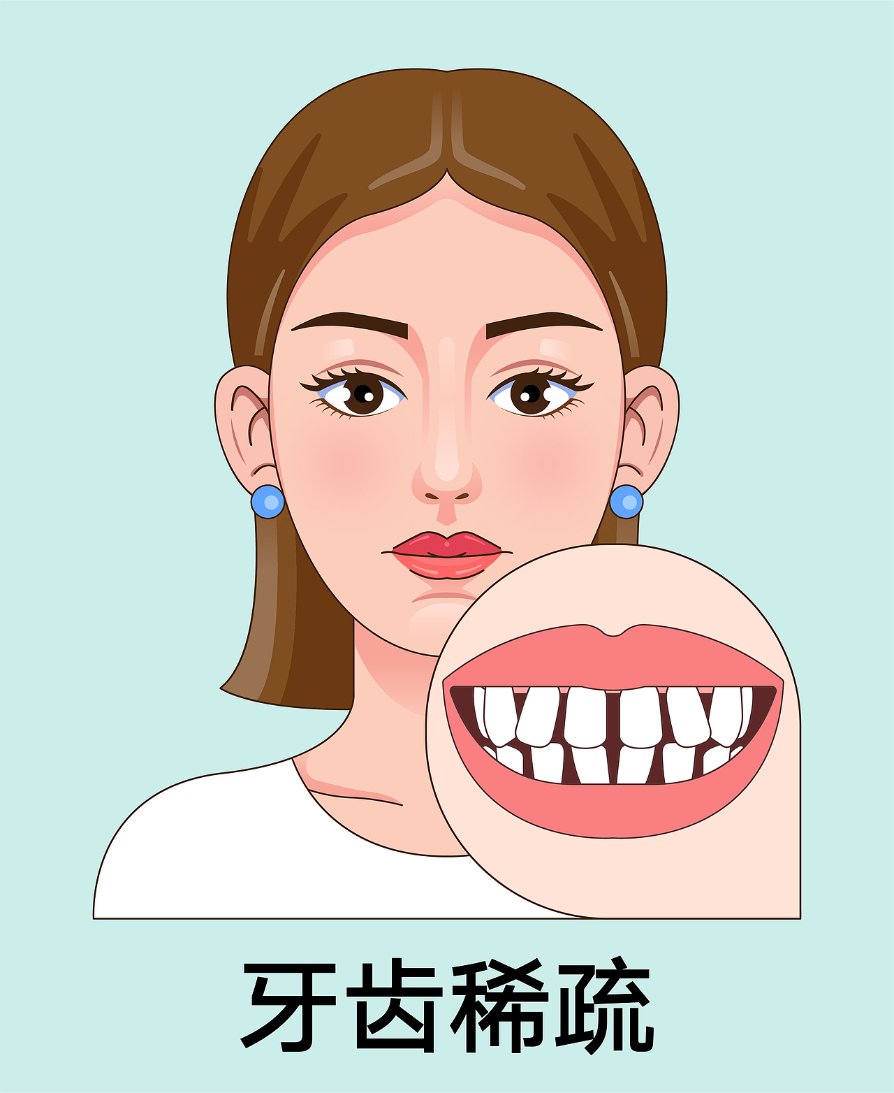 医美 口腔插画 女孩正颜 牙齿矫正类型(绿色背景)