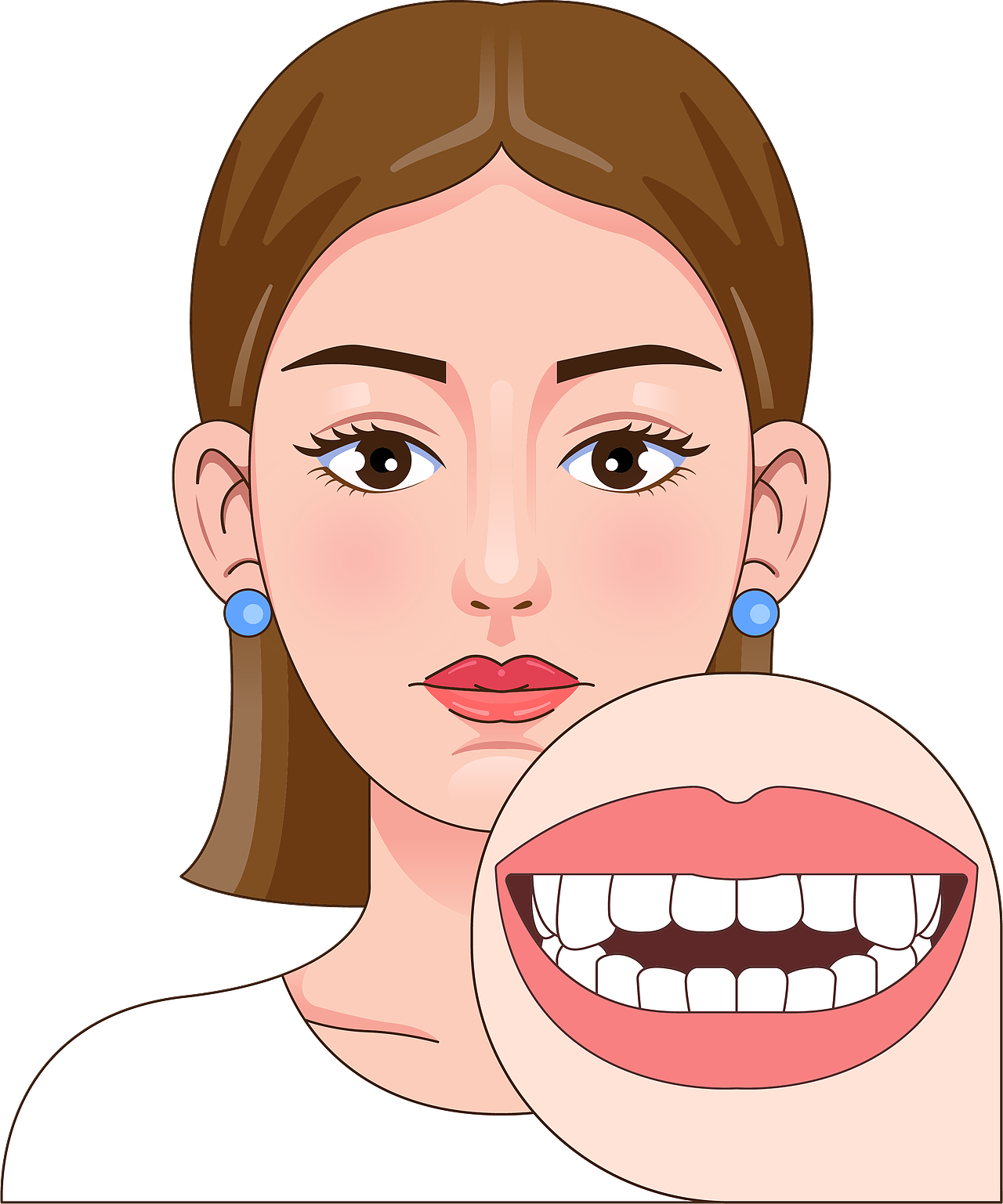 医美 口腔插画 女孩正颜 牙齿矫正类型(透明背景)