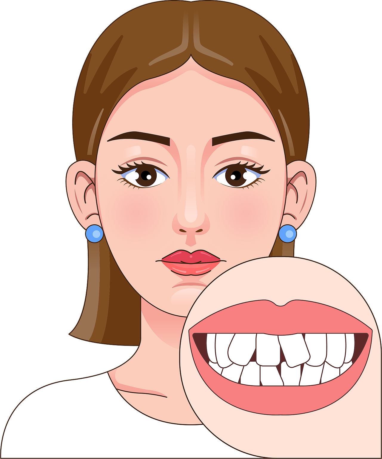 医美 口腔插画 女孩正颜 牙齿矫正类型(透明背景)