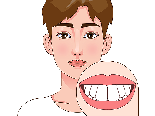 医美 口腔插画 男孩正颜 牙齿矫正类型（白色背景）