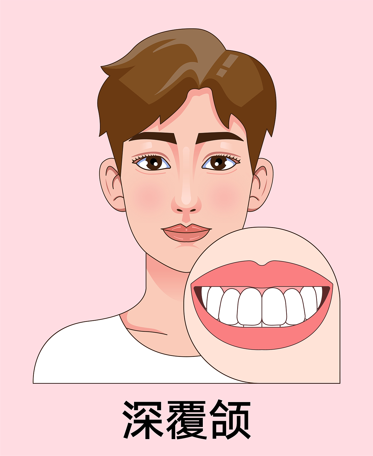 医美 口腔插画 男孩正颜 牙齿矫正类型(红色背景)