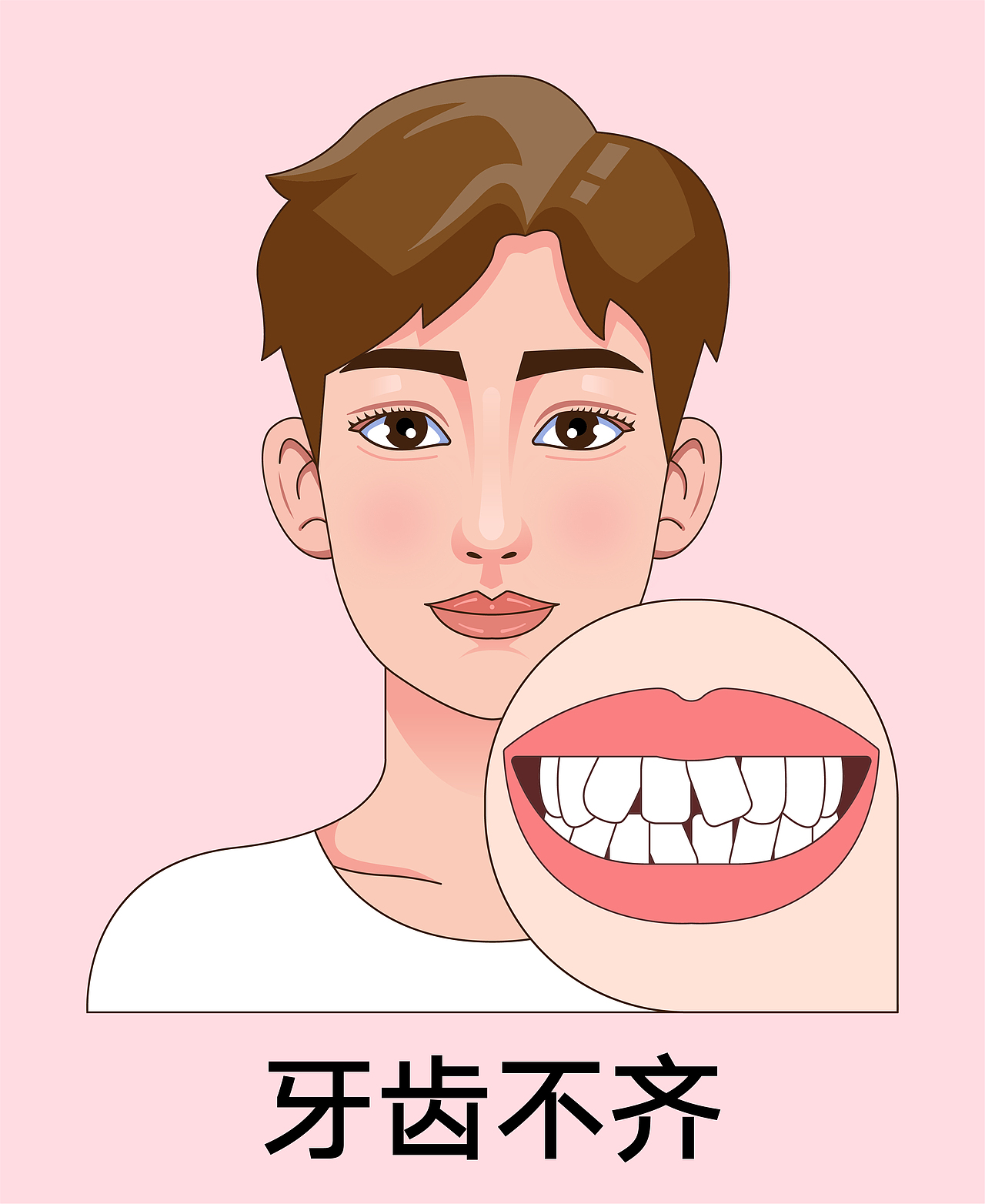 医美 口腔插画 男孩正颜 牙齿矫正类型(红色背景)