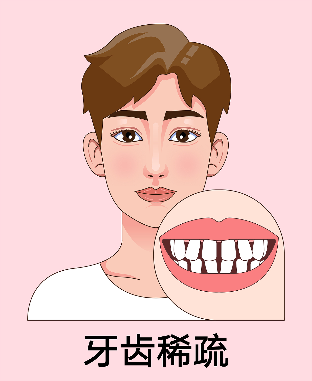 医美 口腔插画 男孩正颜 牙齿矫正类型(红色背景)