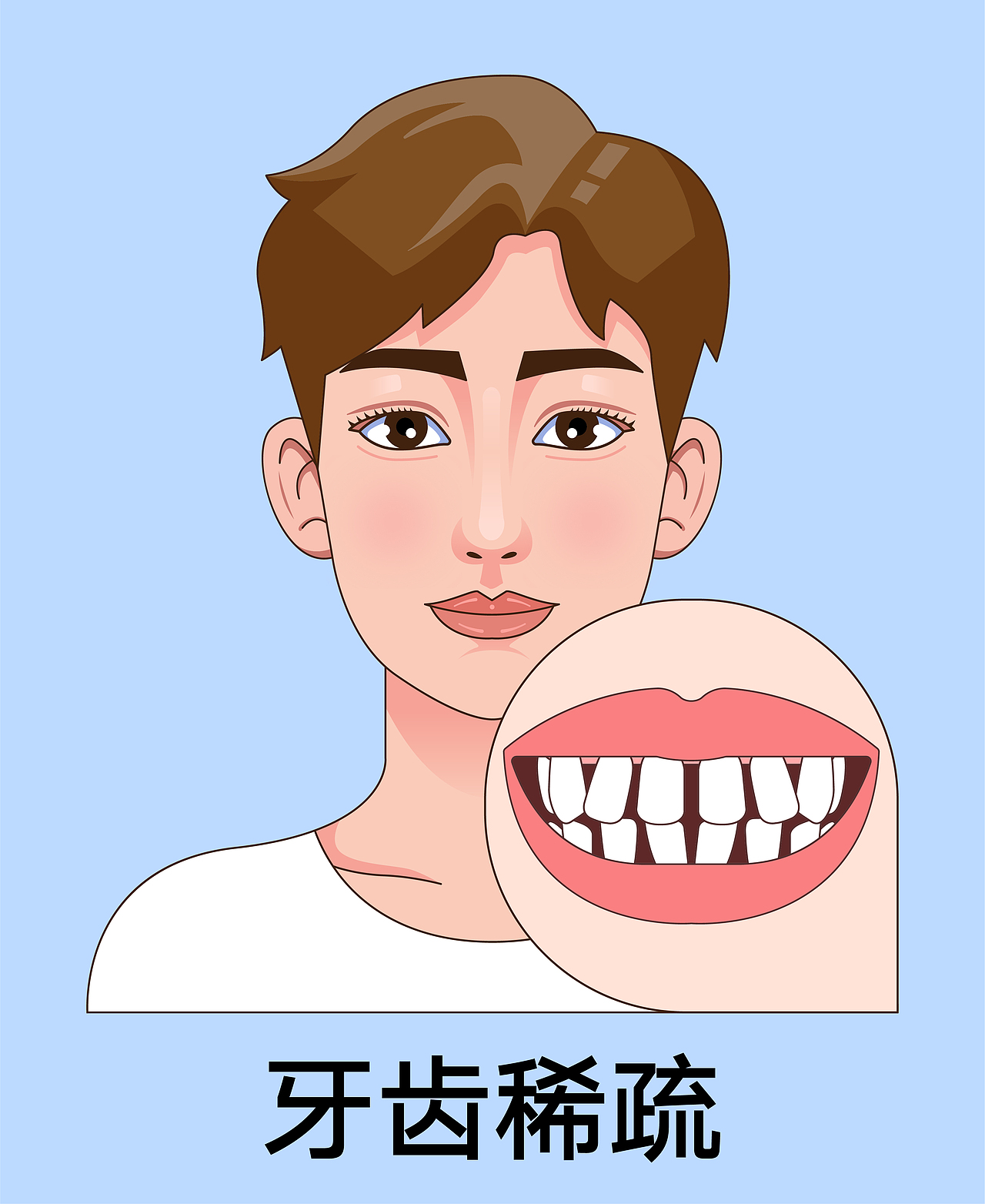 医美 口腔插画 男孩正颜 牙齿矫正类型(蓝色背景)