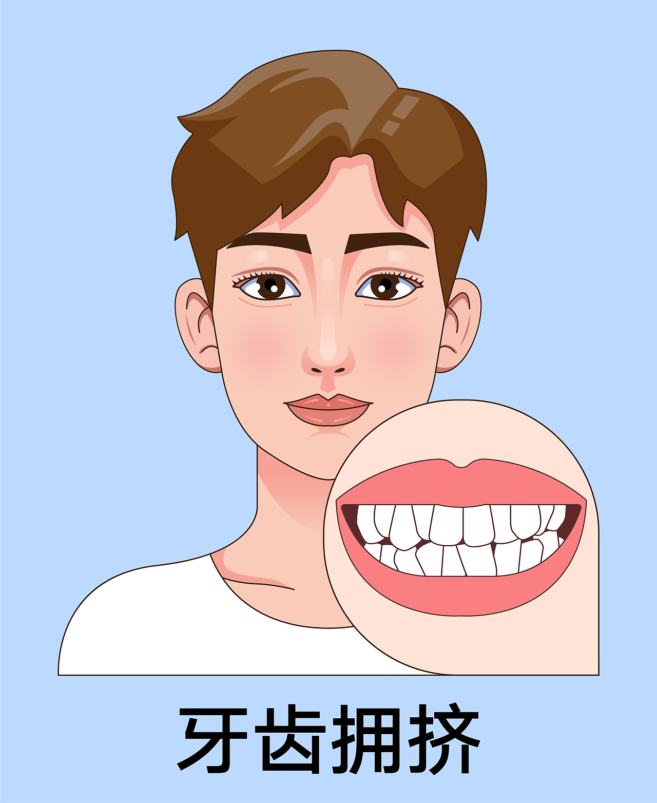 医美 口腔插画 男孩正颜 牙齿矫正类型(蓝色背景)