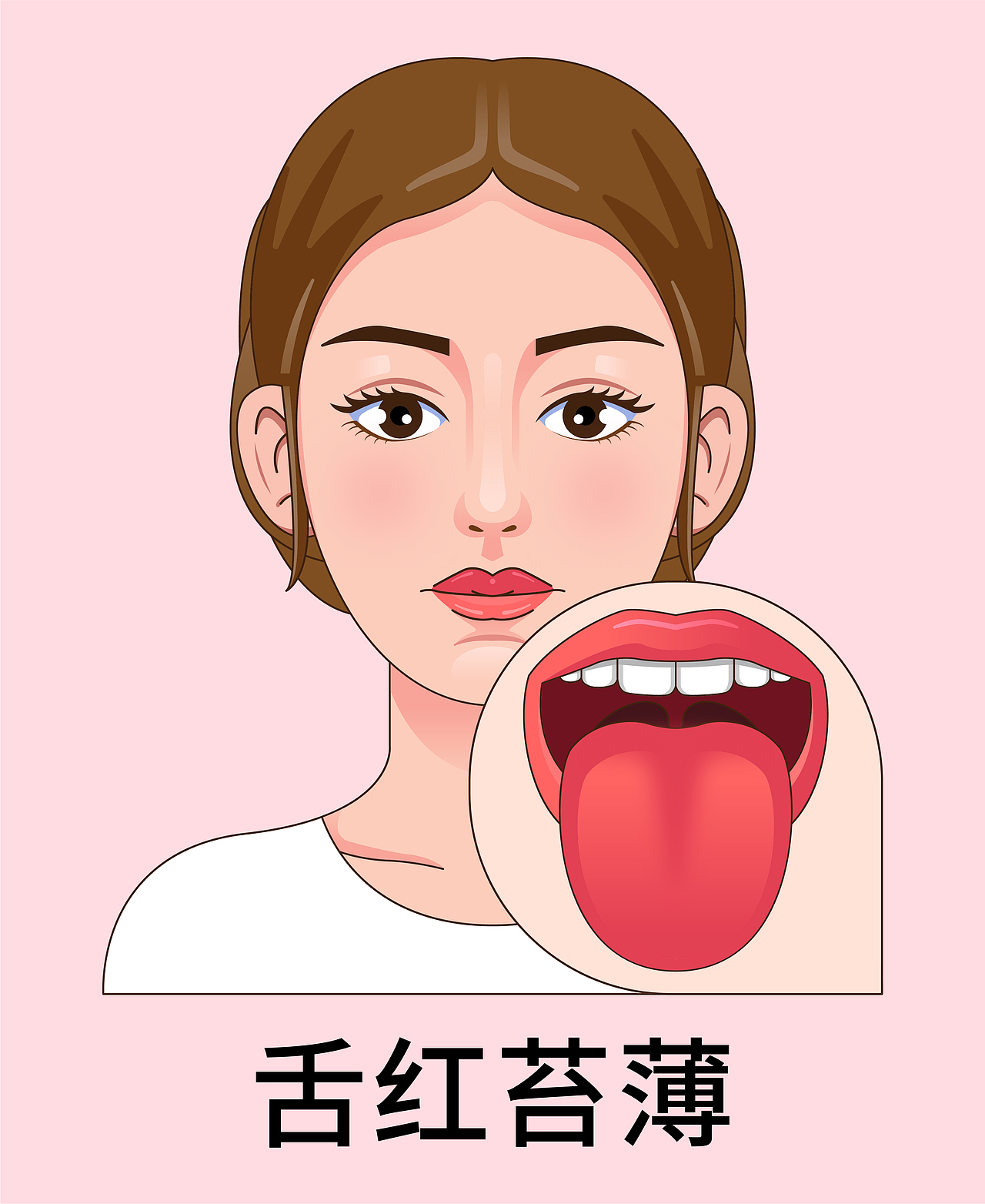 医疗 口腔 中医插画 舌头舌苔类型（女孩-红色背景）（图ZMzkyNTE0MzM2） - 艺术插画 - 站酷设计师想想都开心原创素材 - 站酷ZCOOL