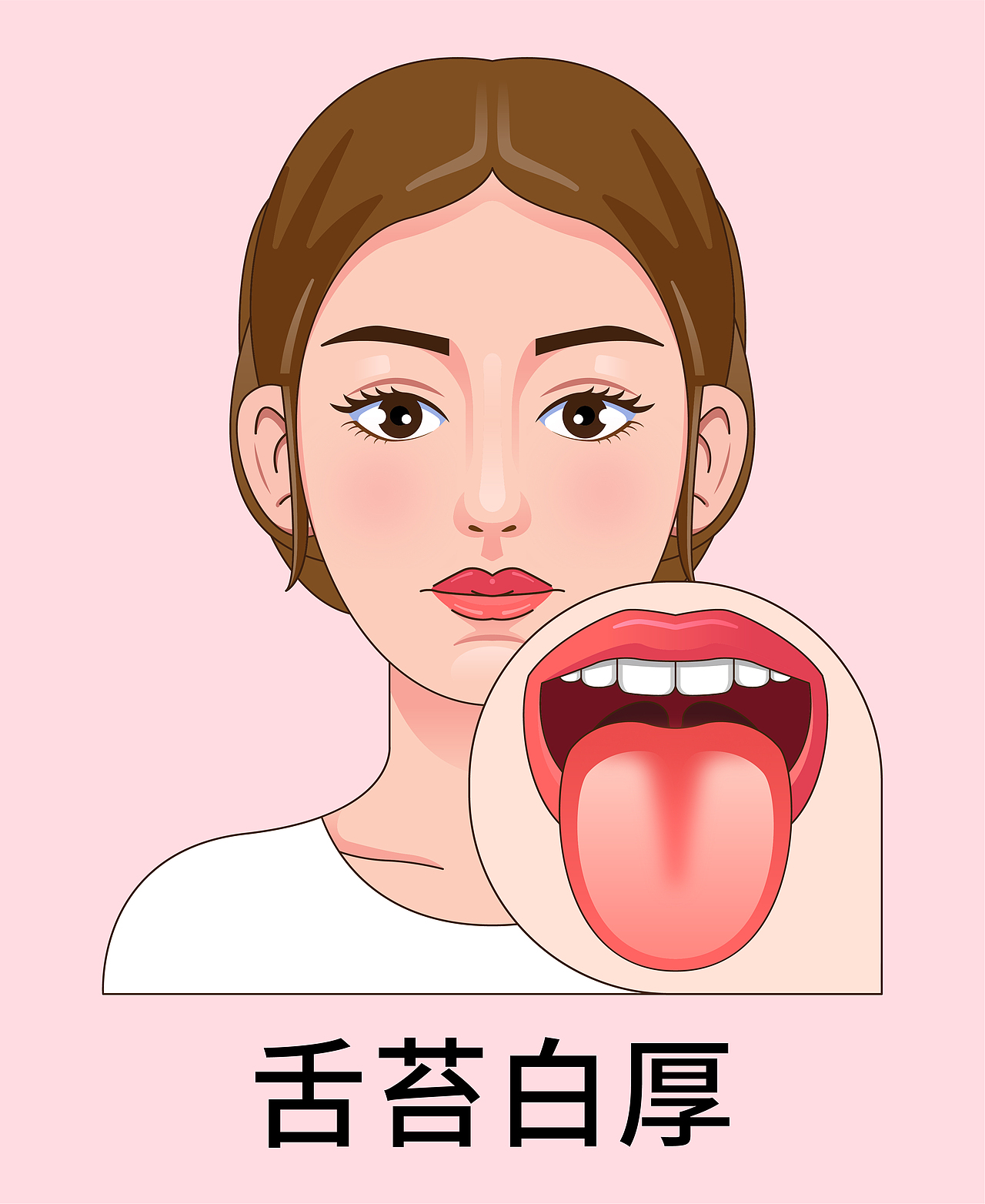 医疗 口腔 中医插画 舌头舌苔类型（女孩-红色背景）（图ZMzkyNTE0MzQw） - 艺术插画 - 站酷设计师想想都开心原创素材 - 站酷ZCOOL