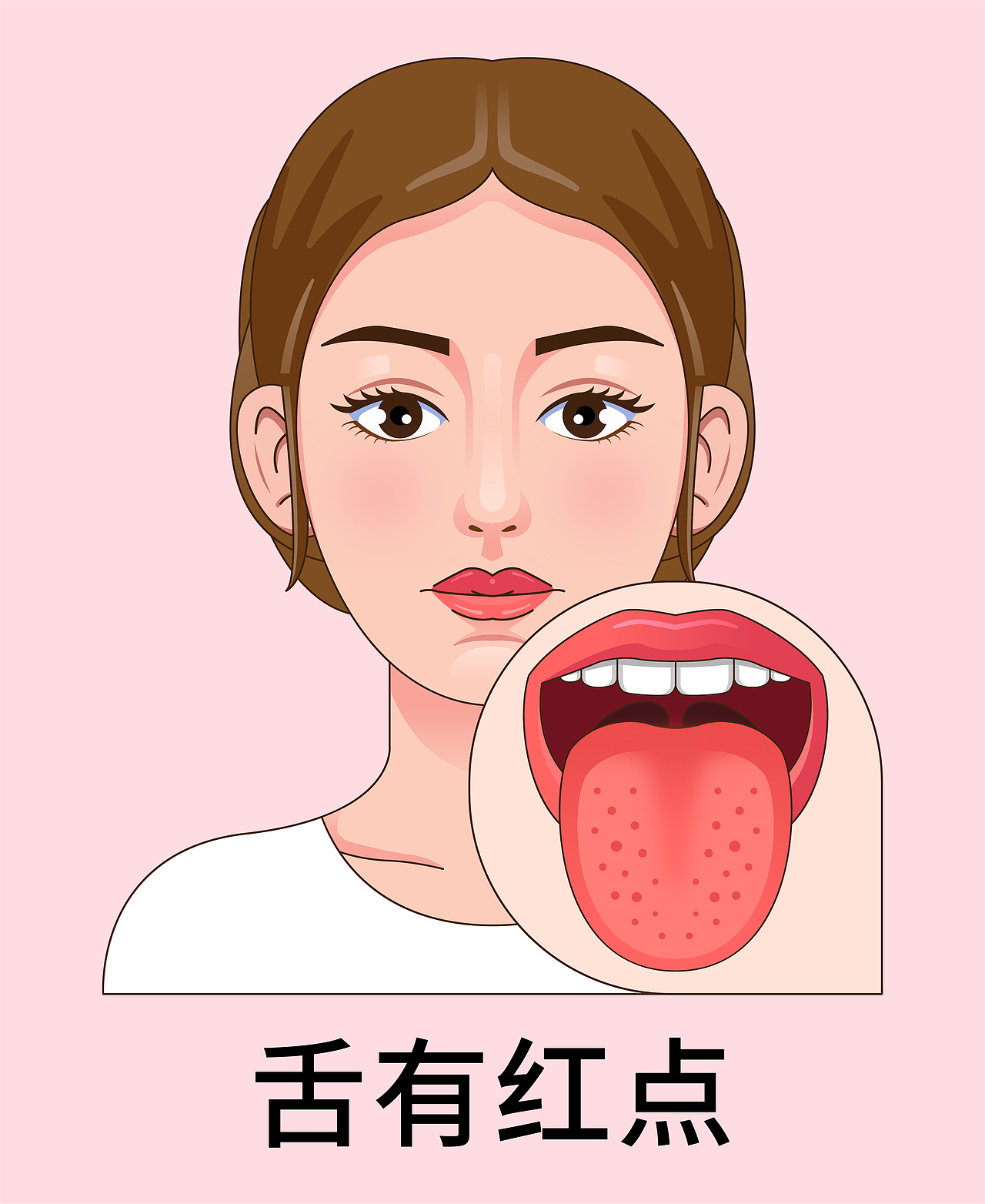 医疗 口腔 中医插画 舌头舌苔类型（女孩-红色背景）（图ZMzkyNTE0MzY0） - 艺术插画 - 站酷设计师想想都开心原创素材 - 站酷ZCOOL