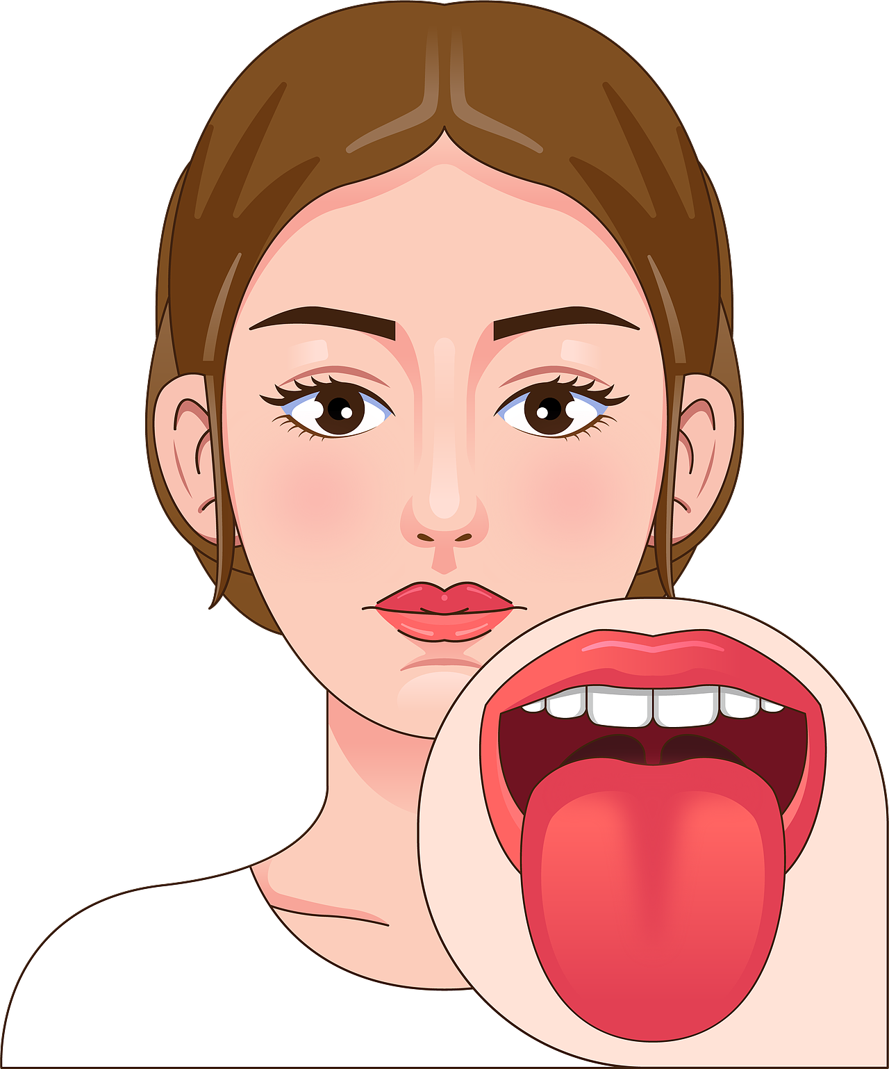 医疗 口腔 中医插画 舌头舌苔类型（女孩-透明背景）（图ZMzkyNTE0NTE2） - 艺术插画 - 站酷设计师想想都开心原创素材 - 站酷ZCOOL