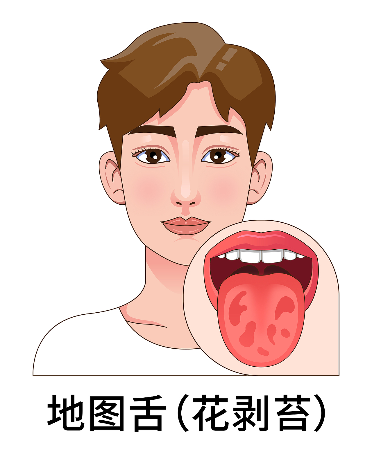 医疗 口腔 中医插画 舌头舌苔类型（男孩-白色背景）