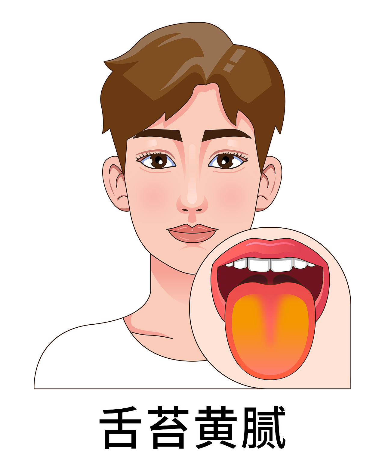 医疗 口腔 中医插画 舌头舌苔类型（男孩-白色背景）