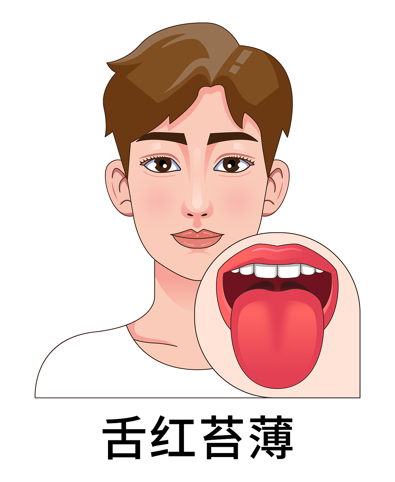 医疗 口腔 中医插画 舌头舌苔类型（男孩-白色背景）