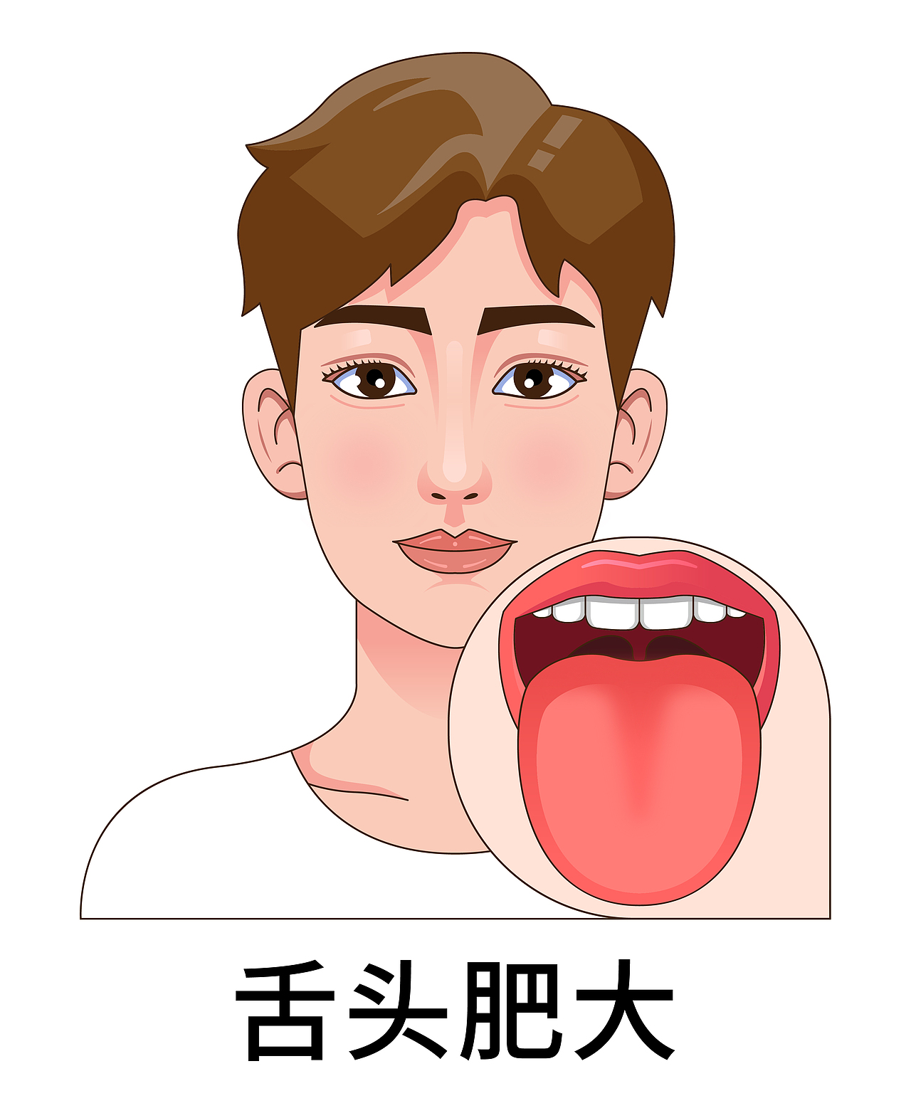 医疗 口腔 中医插画 舌头舌苔类型（男孩-白色背景）