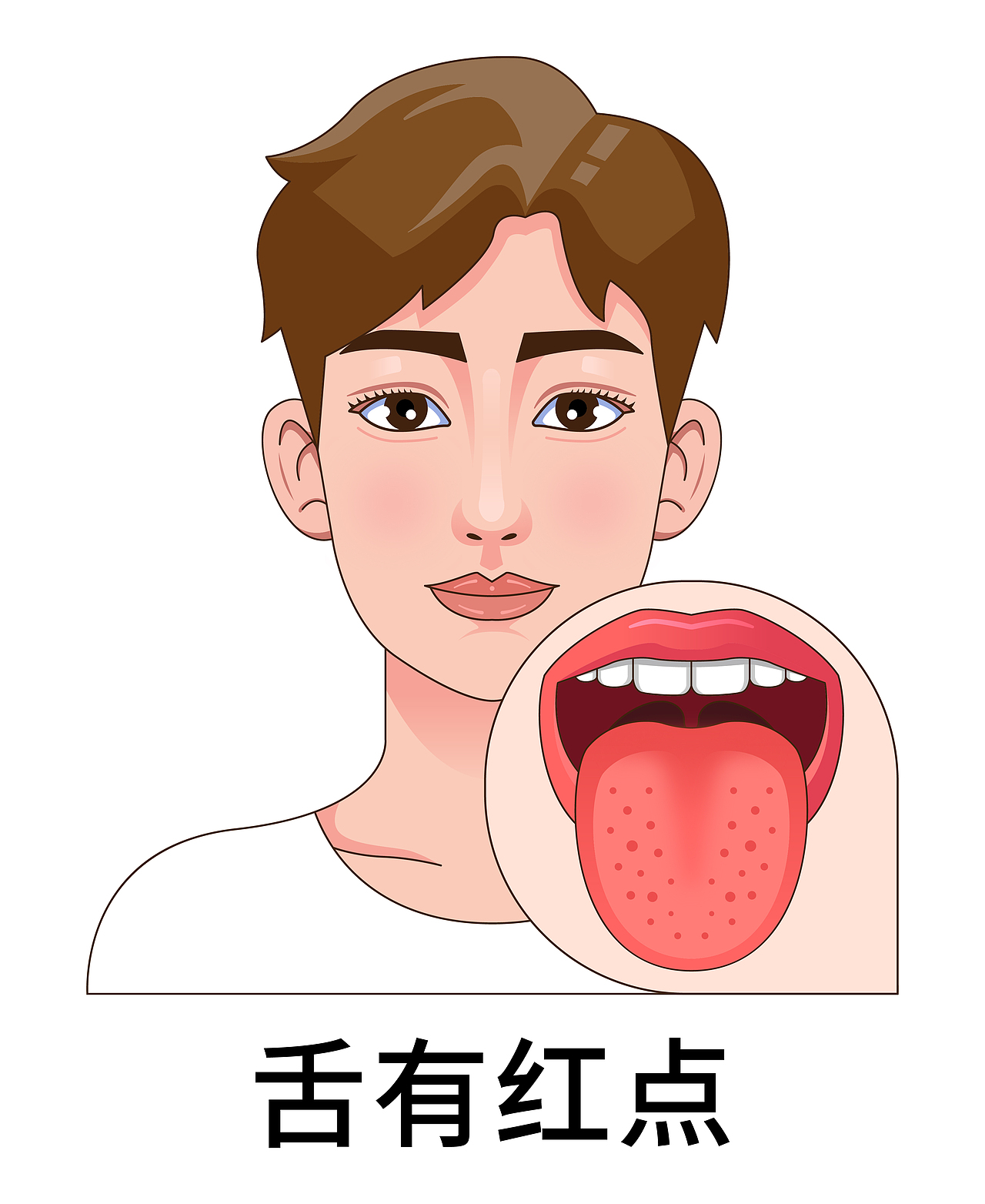 医疗 口腔 中医插画 舌头舌苔类型（男孩-白色背景）