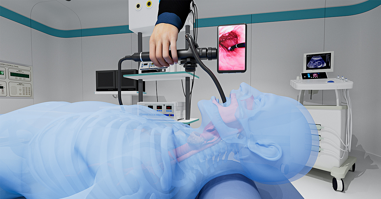 电子胃窥镜设计 x 鲸禧设计