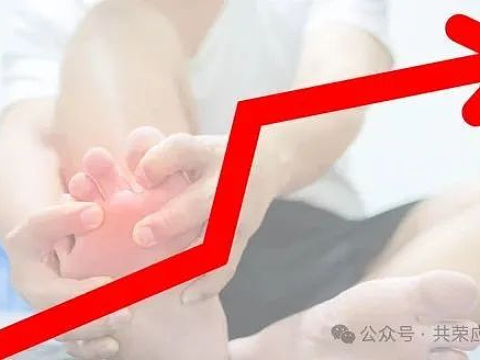 痛风不用怕？！哈佛研究证实4种食物能降低尿酸水平