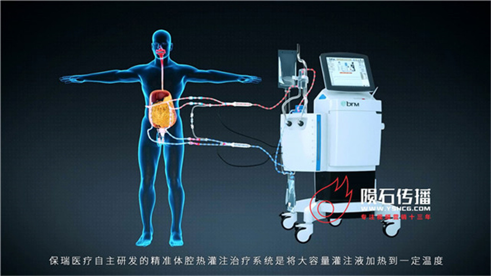 医疗动画让 ICU 设备原理不再高深莫测