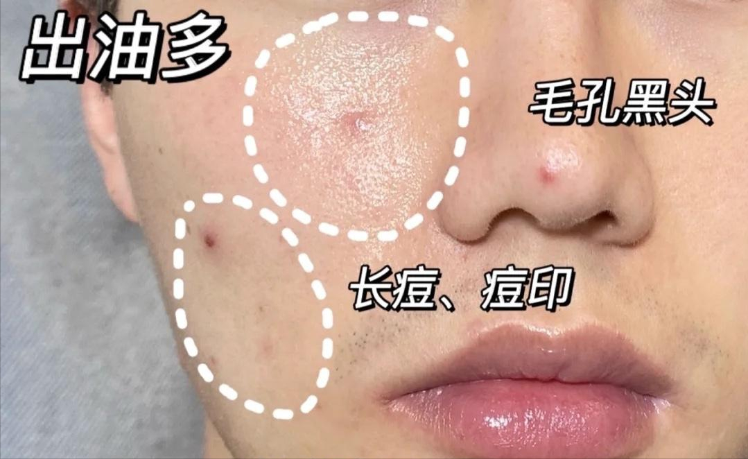 告别“洗后紧绷”!2025年热门男士洁面套装:控油不拔干,抗皱保湿全兼顾