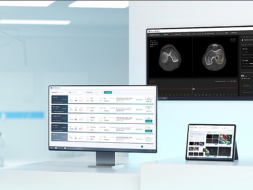 DAPP开发的性能优化